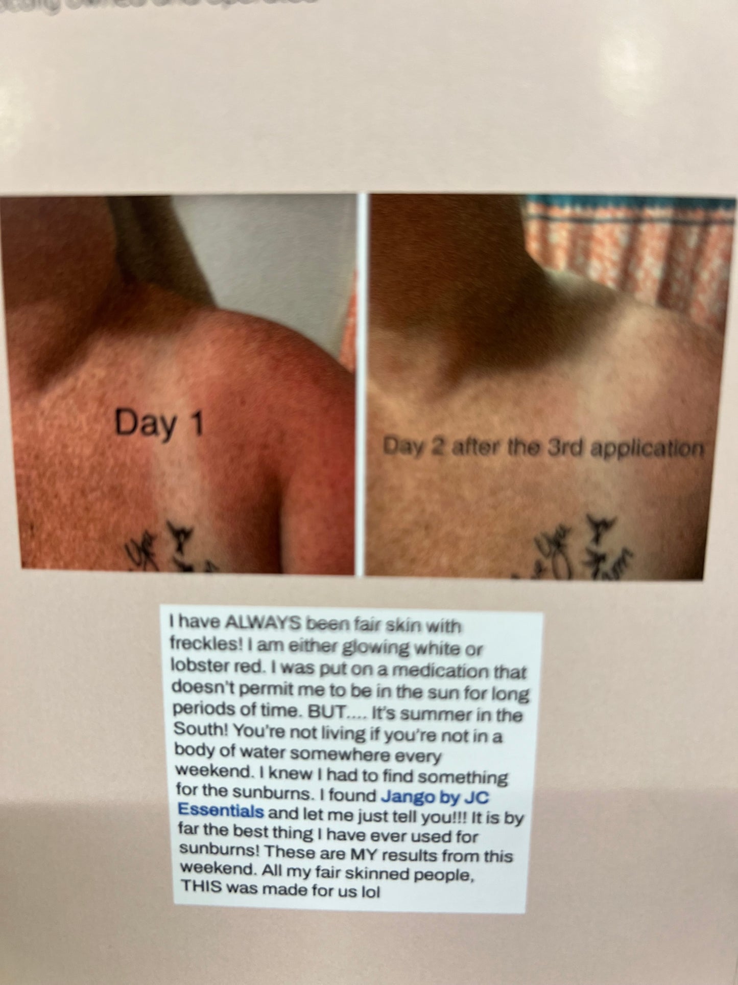 Jango Sunburn Relief Lotion