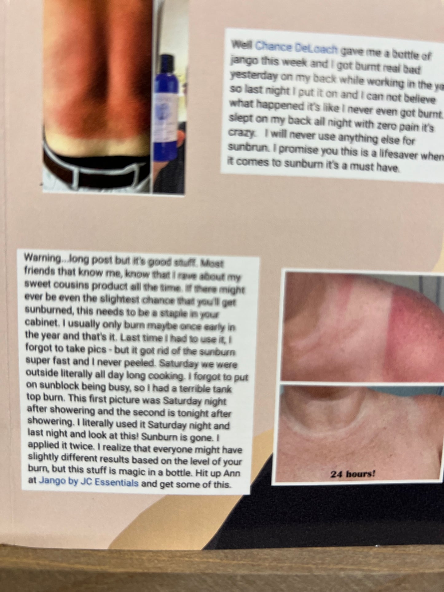 Jango Sunburn Relief Lotion